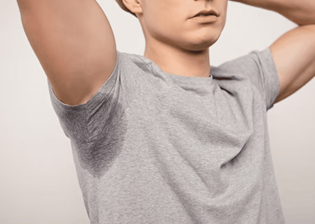 Excessive sweating (hyperhidrosis) treatment in Adelaide, Australia