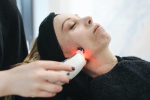 Laser-Skin-Rejuvenation