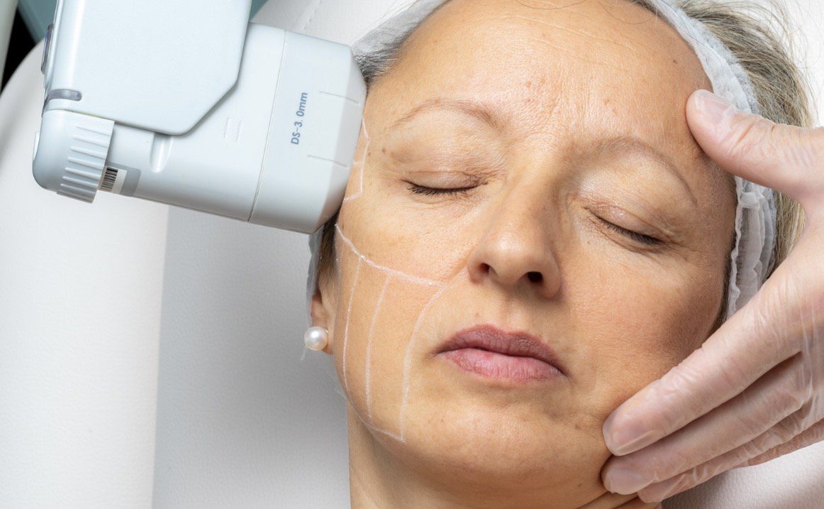 High-Intensity-Focussed-Ultrasound-HIFU