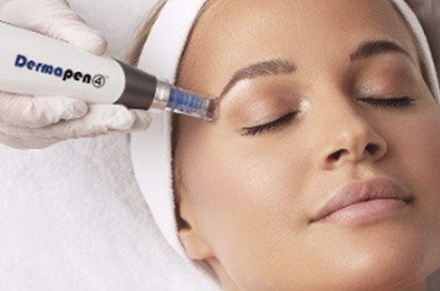 Dermapen 4 Microneedling