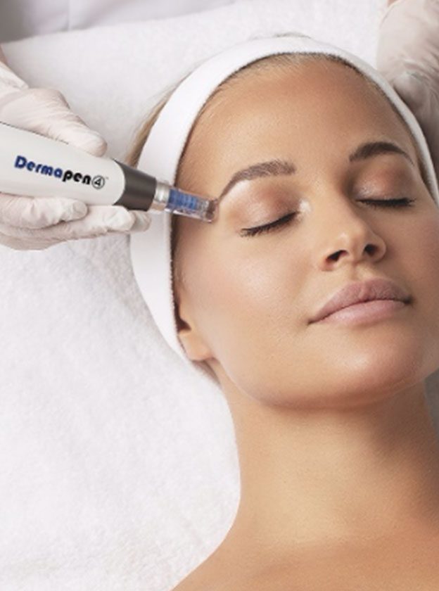dermapen4